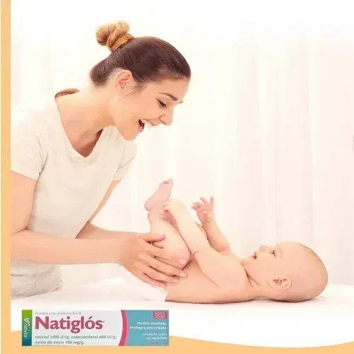 Creme para Assaduras Natiglos 45g