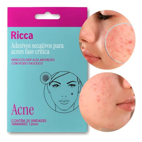 Adesivo Secativo Acne Ricca Fase Inicial 20 Unidades